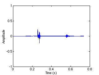 Speech transient